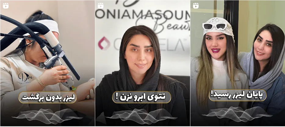 لیزر ارومیه در کلینیک دنیا معصومی کاملا قابل انجام است