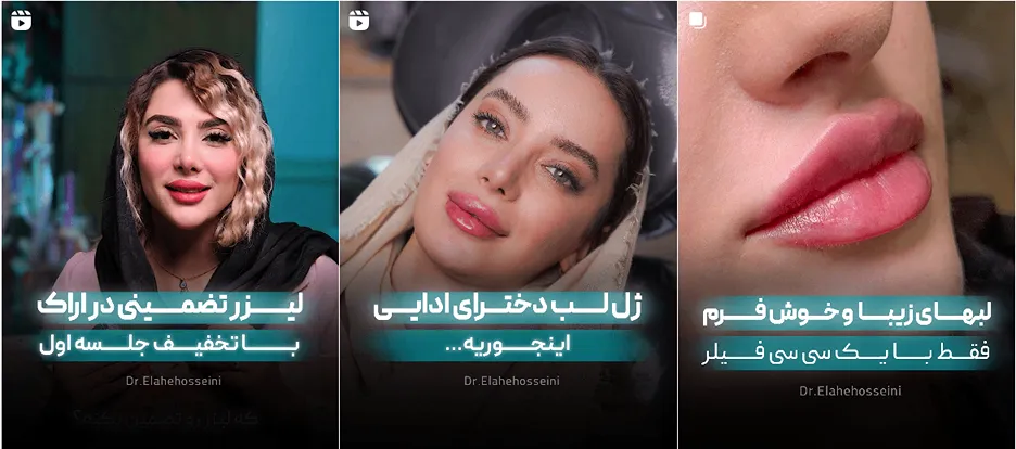 لیزر اراک در کلینیک دکتر حسینی کامالا قابل انجام است