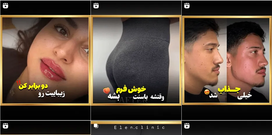 نمونه کار یکی از بهترینی کلینیک زیبایی کرج را مشاهده میفرمایید.