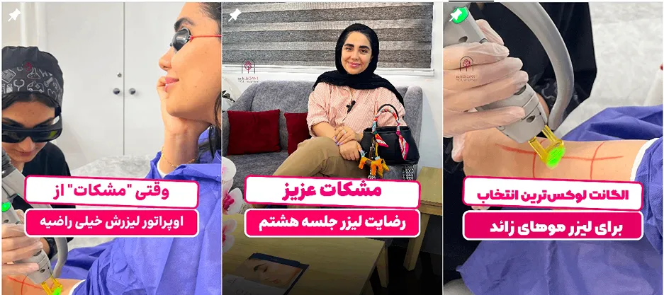 لیزر در ساری در کلینیک زیبایی الگانت کاملا قابل انجام است