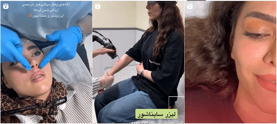 لیزر در اردبیل در کلینیک زیبایی الیت کاملا قابل انجام است