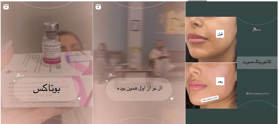 نمونه کار یکی دیگر از بهترین کلینیک زیبایی در بجنورد را مشاهده میفرمایید.