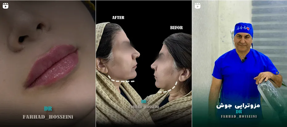 نمونه کار یکی دیگر از بهترین کلینیک زیبایی یاسوج را مشاهده میفرمایید.