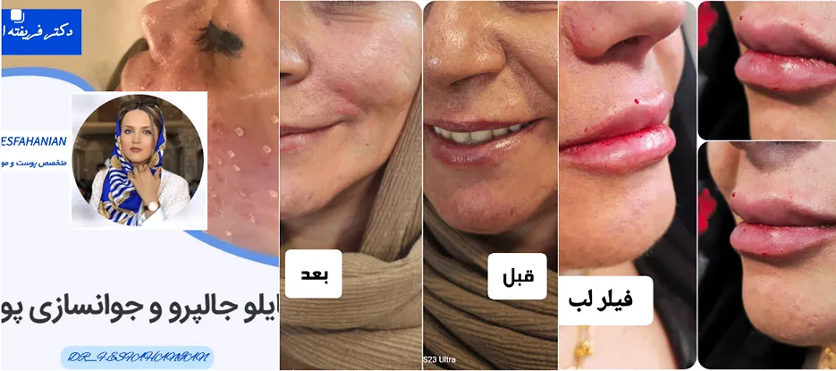 در این قسمت نیز میتوانید نمونه کارهای دکتر اصفهانیان را مشاهده بفرمایید.