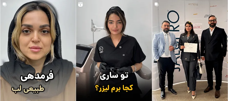 لیزر ساری در کلینیک دکترفرناز کاملا قابل انجام است