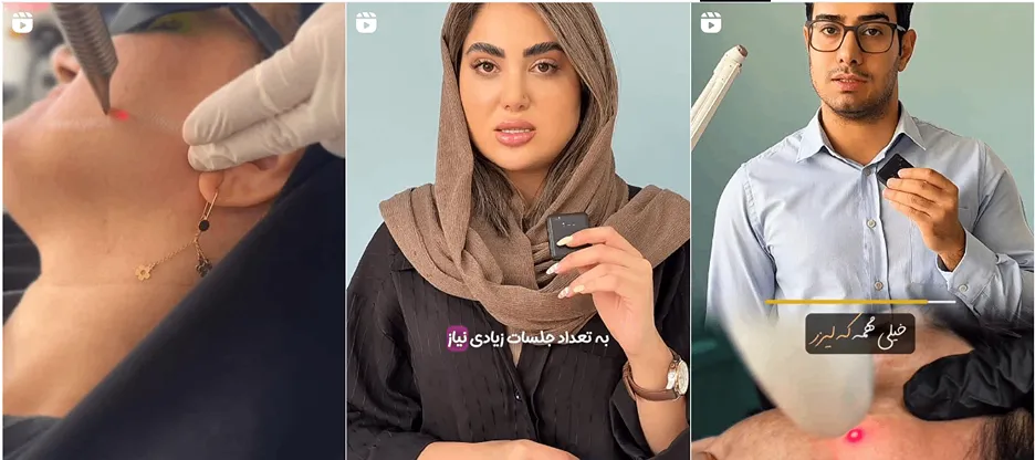 نمونه کار یکی از بهرتین کلینیک زیبایی در ایلام را مشاهده میفرمایید.