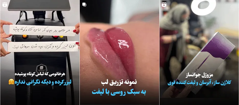 لیزر در ارکا در کلینیک دکتر حشمتی کاملا قابل انجام است