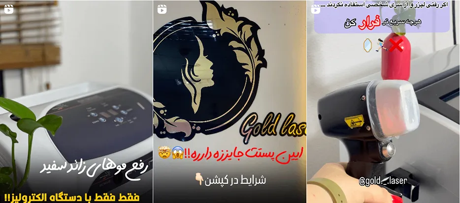 انجام لیزر در بوشهر در کلینیک زیبایی گلد کاملا قابل انجام است