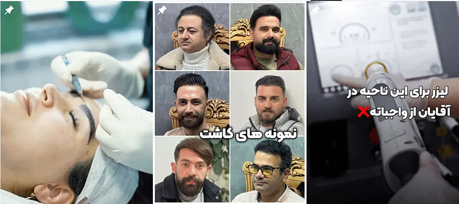 لیزر در تبریز در کلینیک زیبایی جکیمان کاملا قابل انجام است