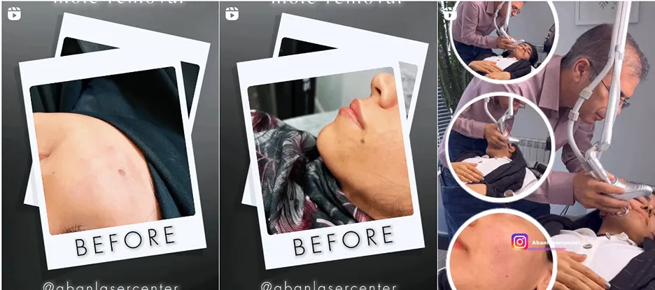 نمونه کار یکی دیگر از مدرنترین کلینیک زیبایی در خرم آباد را مشاهده میفرمایید.