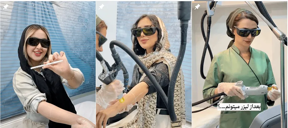 لیزر در شیراز در کلینیک زیبایی همتیان کاملا قابل انجام است