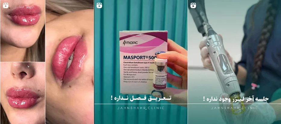 نمونه کار یکی از بهترین کلینیک لیزر در کرج را مشاهده میفرمایید.