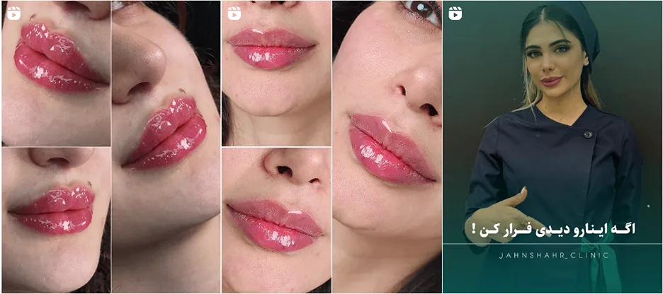 نمونه کار یکی از بروزترین کلینیک زیبایی کرج را در اینجا مشاهده میفرمایید.