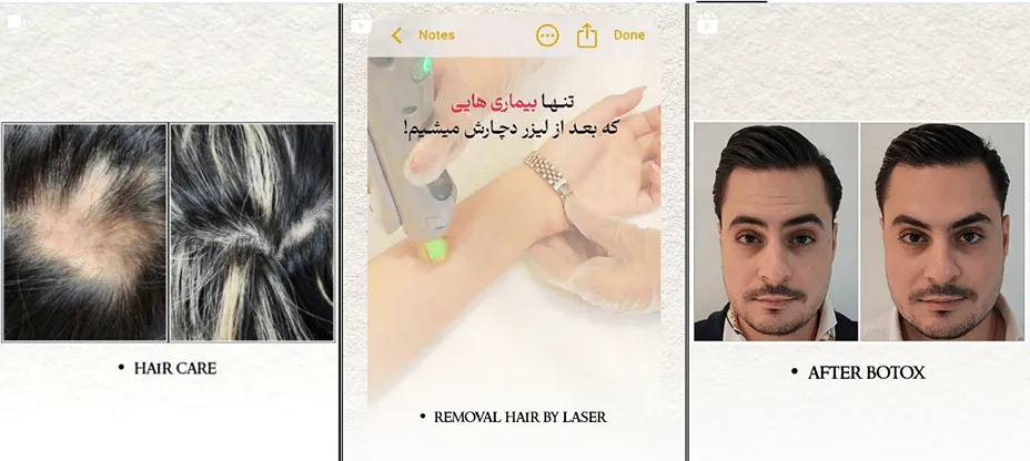 لیزر در کرج در کلینیک زیبایی کاملیا کاملا قابل اجرا است