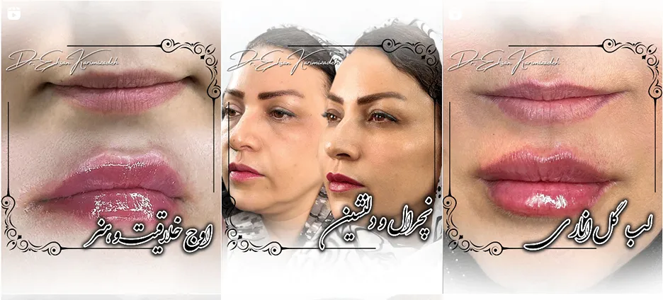 دکتر کریمی زاده از بهترین دکترین کلینیک زیباییی یاسوج است