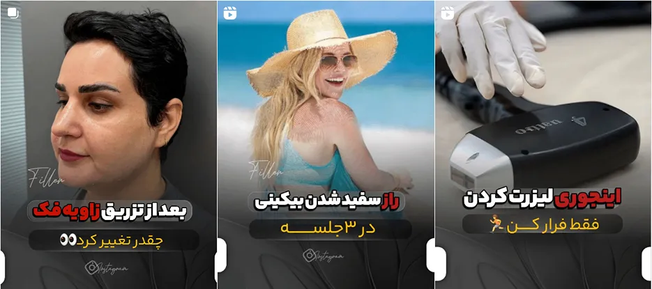 لیزر در ساری در کلینیک زیبایی کاژه کاملا قابل انجام است