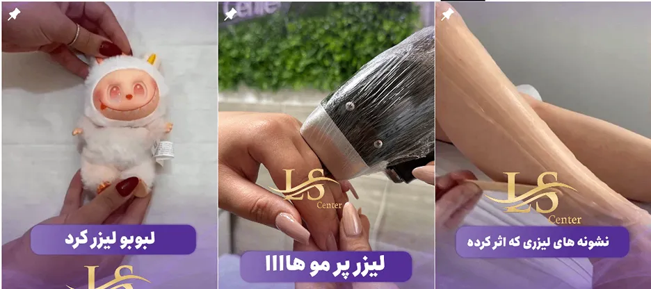 لیزر ارومیه در کلینیک دکتر کیانی راد کاملا قابل انجام است