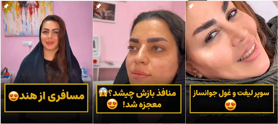 نمونه کار کلینیک زیبایی لبخند شیرین را در این تصویر میتوانید مشاهده بفرمایید