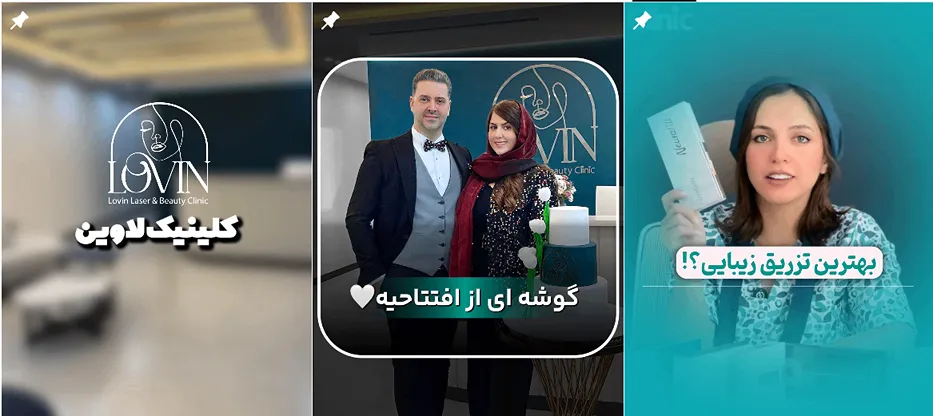 لیزر اراک در کلینیک زیبایی لاوین کاملا قابل انجام است