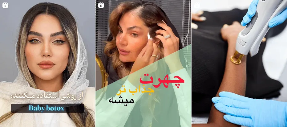 نمونه کار یکی از بهترین کلینیک لیزر تهران را مشاهده میفرمایید.