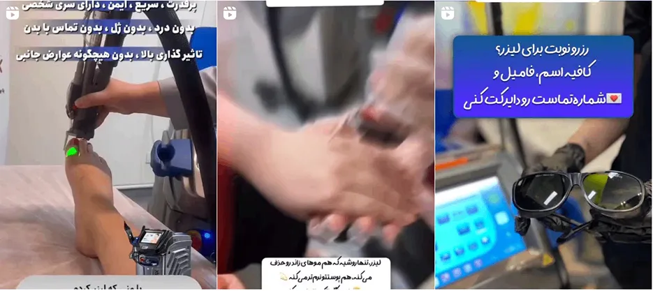 نمونه کار یکی از بهترین مراکز لیزر اردبیل را مشاهده میفرمایید.