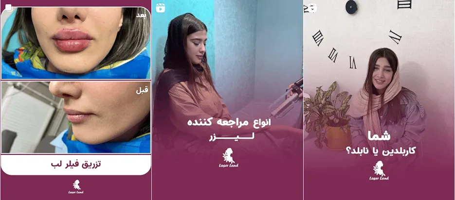 نمونه کار یکی از بهترین مرکز لیزر کرمانشاه را مشاهده میفرمایید.