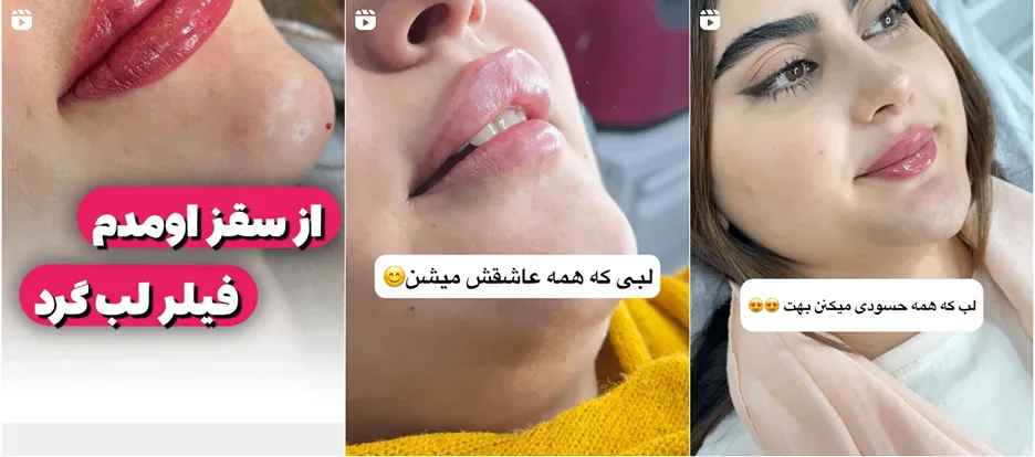 نمونه کار یکی از بهترین کلینیک زیبایی در سنندج را د این قسمت میتوانید مشاهده بفرمایید.