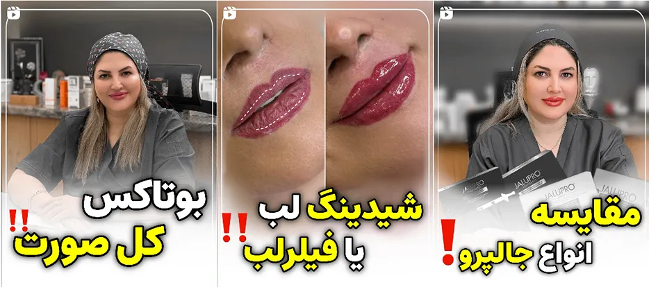 نمونه کار دکتر مقبولی از بهترین کلینیک زیبایی زنجا را د ایجا مشاهده میفرمایید.