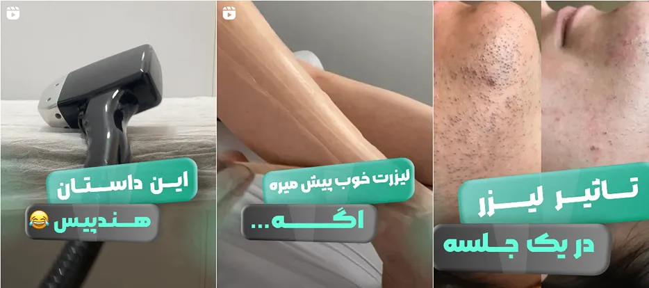 لیزر اراک در کلینیک نهال کاملا قابل انجام است