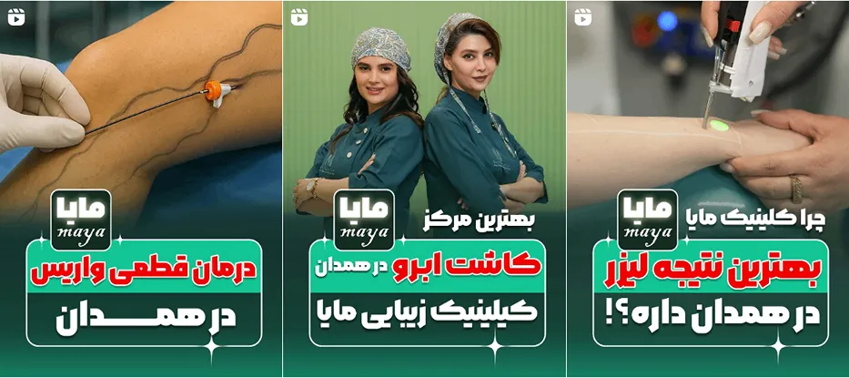 نمونه کار یکی از مجهزترین کلینیک لیزر در همدان را مشاهده میفرمایید.