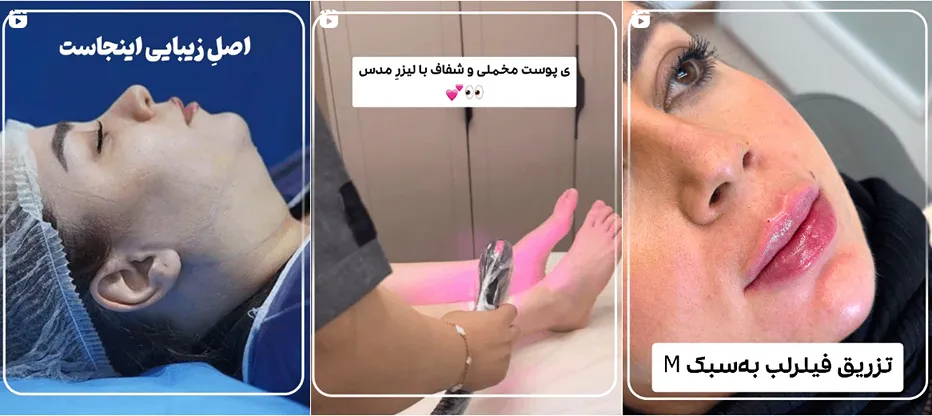 کلینیک زیبایی مدس یکی از بهترین مرکز لیزر در کرج است