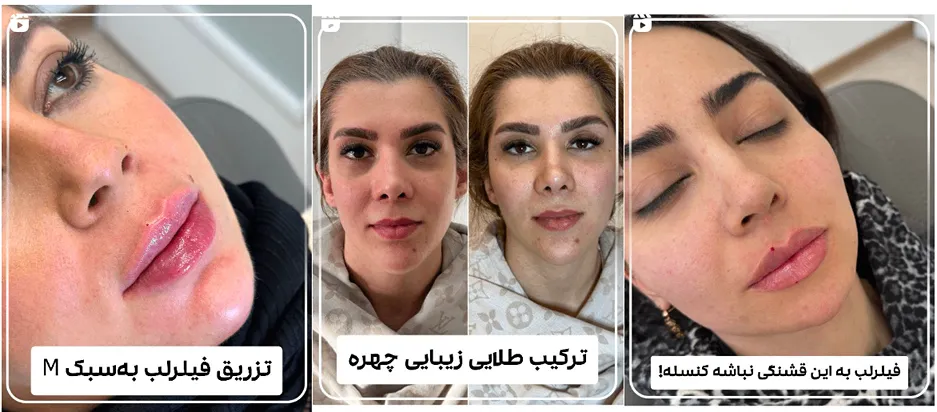 نمونه کار کلینیک زیبایی مدس را در این تصویر مشاهده میفرمایید.