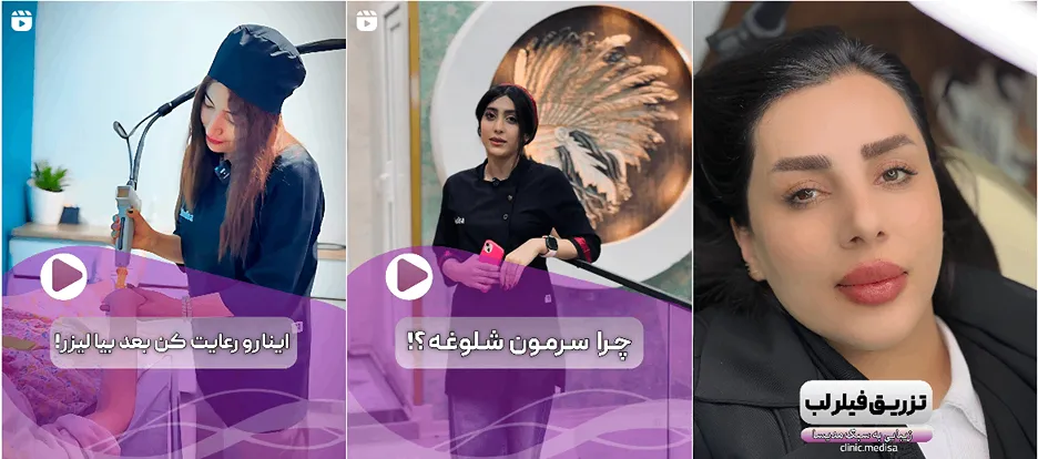 نمونه کار یکی از بهترین کلینیک زیبایی یاسوج را مشاهده میفرمایید.