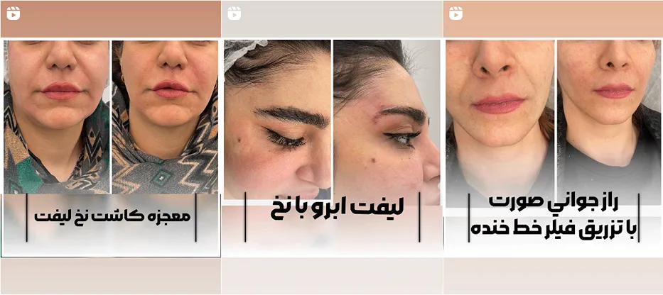 نمونه کار مجهزترین کلینیک زیبایی ایلام را مشاهده میفرمایید.