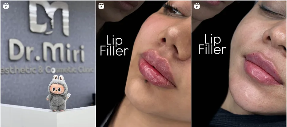 نمونه کار کلینیک زیبایی دکتر میری را د اینجا مشاهده میفرمایید.