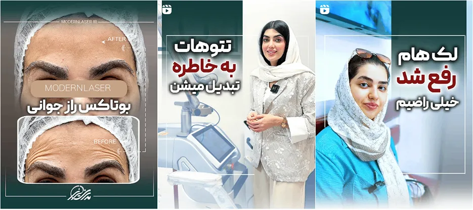 نمونه کار یکی از بهترین مرکز لیزر اصفهان را مشاهده میفرمایید.