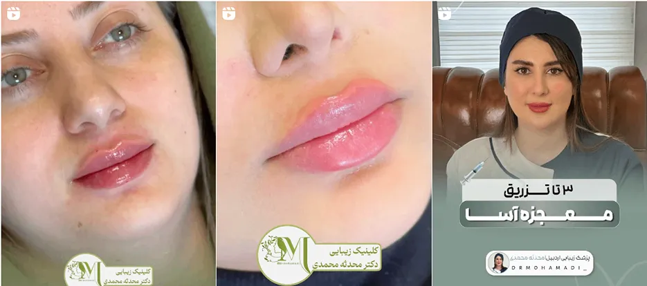 نمونه کار یکی از بهترین مراکز لیر اردبیل را مشاهده میفرمایید.