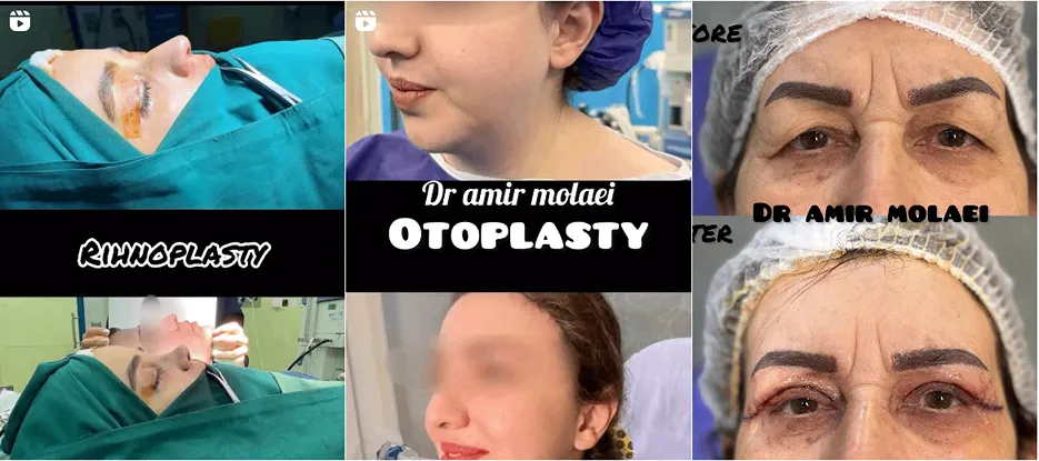 نمونه کار دکت مولایی را در این تصویر میتوانید مشاهده بفرمایید.