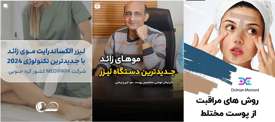 نمونه کار یکی از بهترین کلینیک لیزر در اصفهان را میتوانید مشاهده بفرمایید.