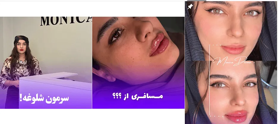 نمونه کار یکی از برترین کلینیک زیبایی سمنان را مشاهده میفرمایید.