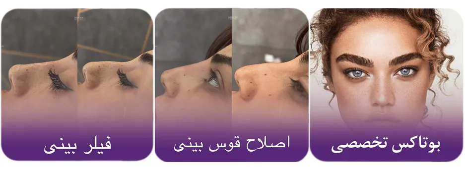 نمونه کار کلینیک مون را در این قسمت میتوانید مشاهده میفرمایید.