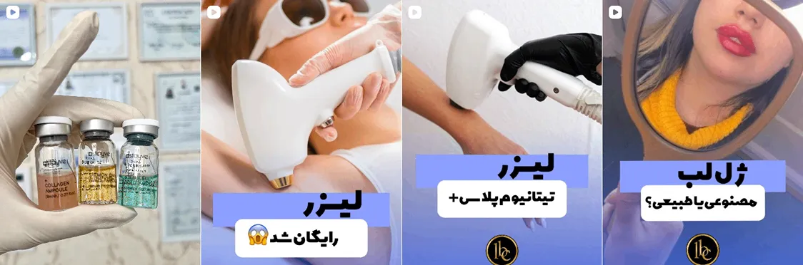 نمونه کار بهترین کلینیک لیزر در تهران را مشاهده میفرمایید.