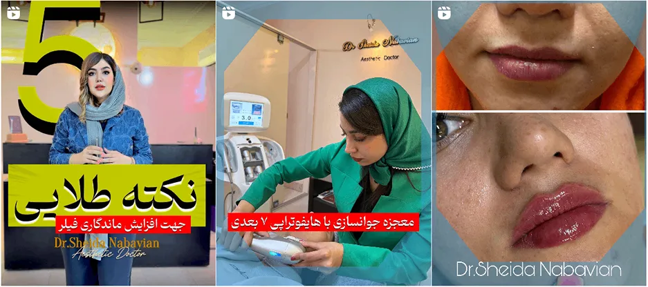 نمونه کار شیدا نبویان را در این تصاویر میتوانید مشاهده بفرمایید.