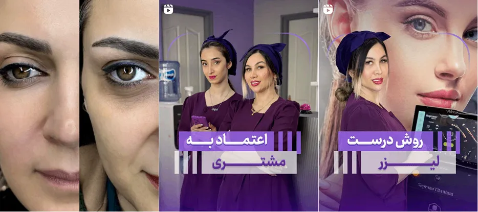 لیزر در کرج در کلینیک نیلوفر کاملا قابل انجام است