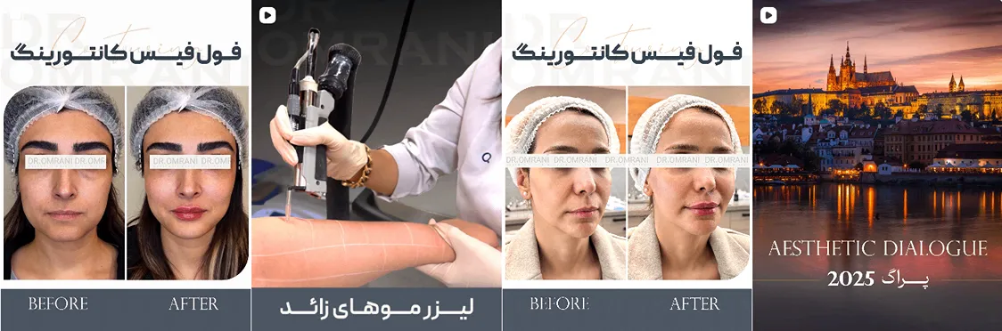 لیزر تبریز در کلینیک دکتر عمرانی کاملا قابل انجام است