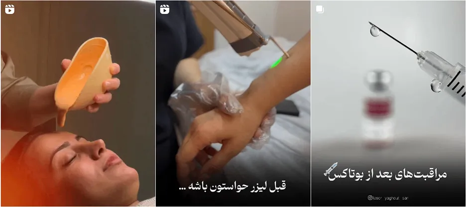 نمونه کار یکی از بهترین کلینیک لیزر در ساری را مشاهده میفرمایید.