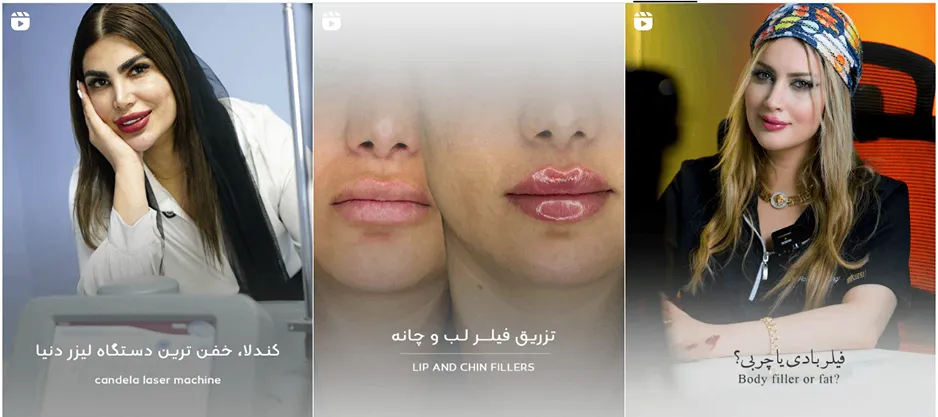 نمونه کار لیزر د شیراز کلینیک زیبایی پارسه را میتوانید مشاهده بفرمایید.