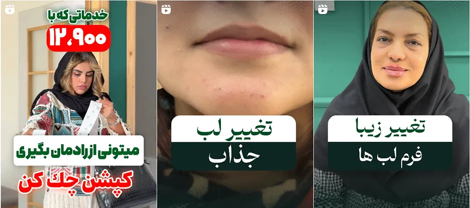 نمونه کار کلینیک زیبایی رادمان را در این تصوایر میتوانید مشاهده بفرمایید.