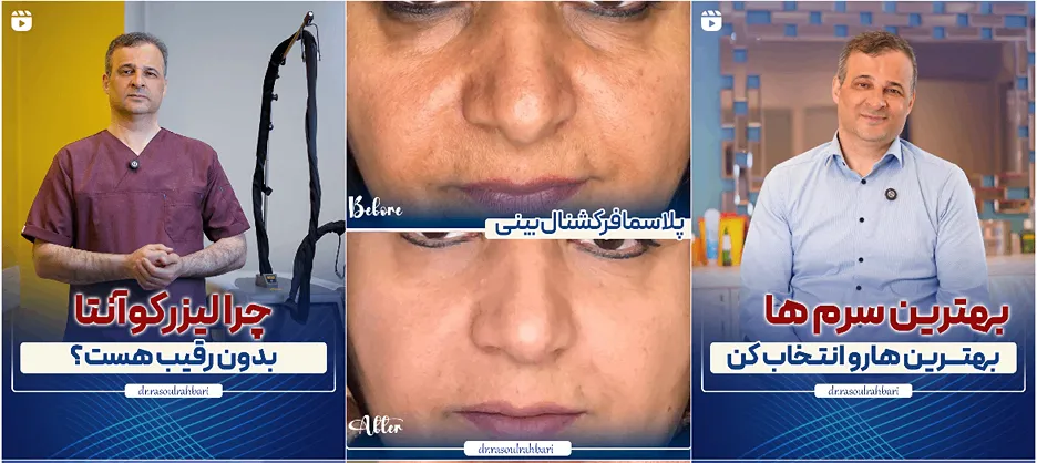 کلینیک دکتر رهبری از بروزترین کلینیک لیزر در تبریز است