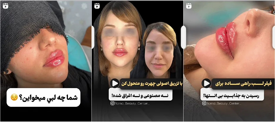 نمونه کلینیک زیبایی راما را در این قسمت مشاهده میفرمایید.